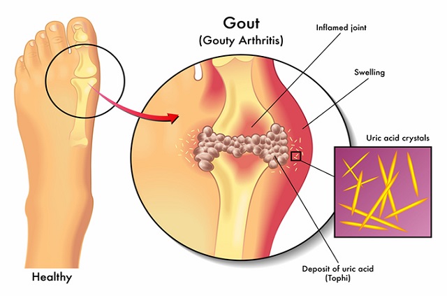 Services - Joint Pain